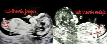 s-nub-theorie-echo-geslacht-baby-jongen-meisje NUB theorie